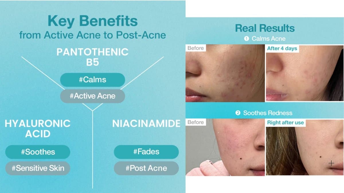 Numbuzin - No.1 Pantothenic B5 Hyaluronic Active Clear Mask alt